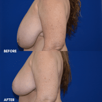 FMPS B & A