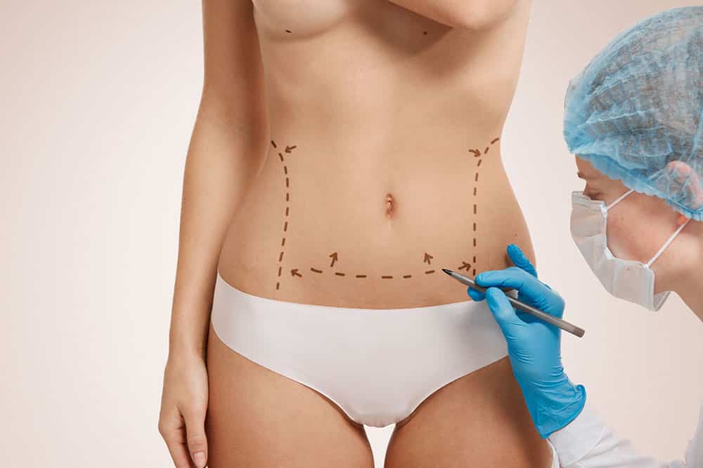 Tummy Tuck – Abdominoplasty –  How do I know if I need one? Tummy Tuck - Abdominoplasty -  How do I know if I need one?