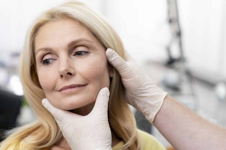 Recovery After a Deep Plane Facelift