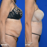 OLD FMPS B&A Template - TT W/ Flank Lipo (2)