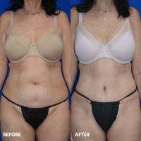 OLD FMPS B&A Template - TT w/ flank lipo OLD FMPS B&A Template - TT w/ flank lipo