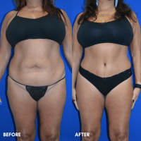 FMPS B&A Template - 94