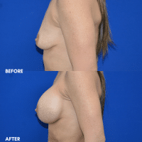 FMPS/CFPS B&A Templates Website - BBA- A3