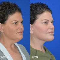 2025-12-15-deepplanefacelift-01-2