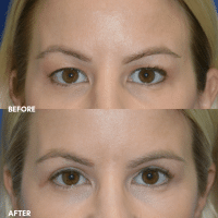FMPS B&A Template - IA